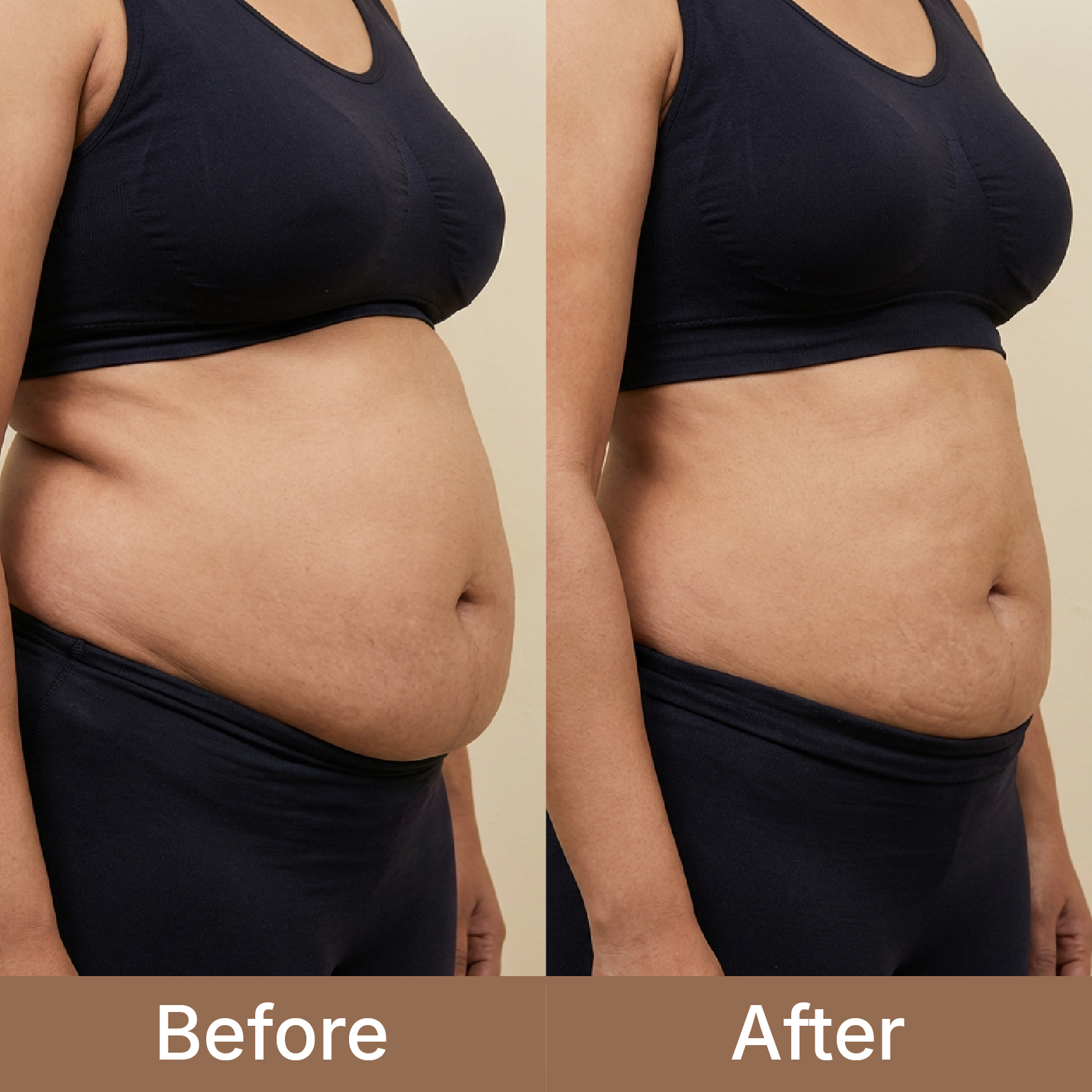 treatment-before-after-3-max-